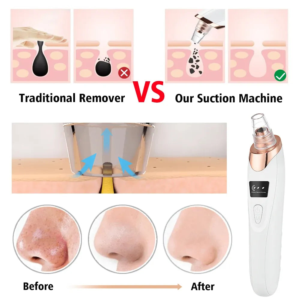 PoreGlow – Vacuum Purifier