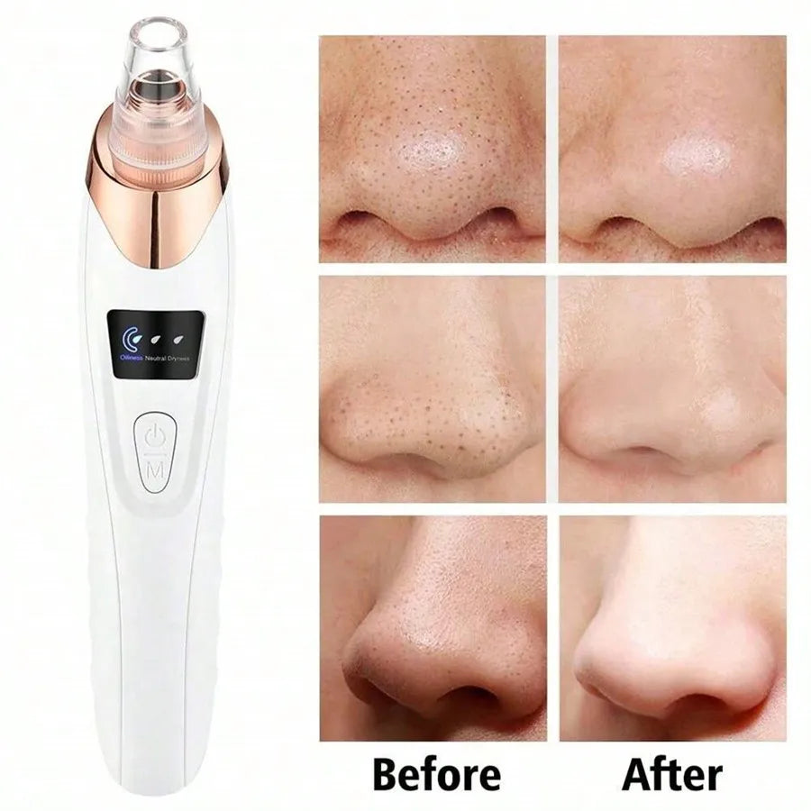 PoreGlow – Vacuum Purifier